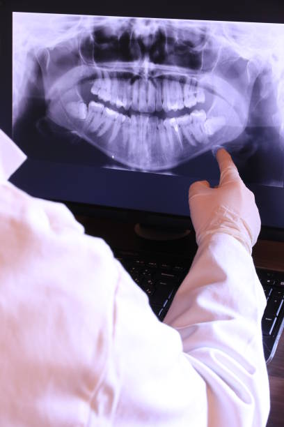 Best Same-Day Emergency Dental Services in Maxton, NC