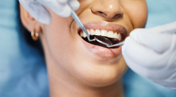 Best Same-Day Emergency Dental Services in Maxton, NC